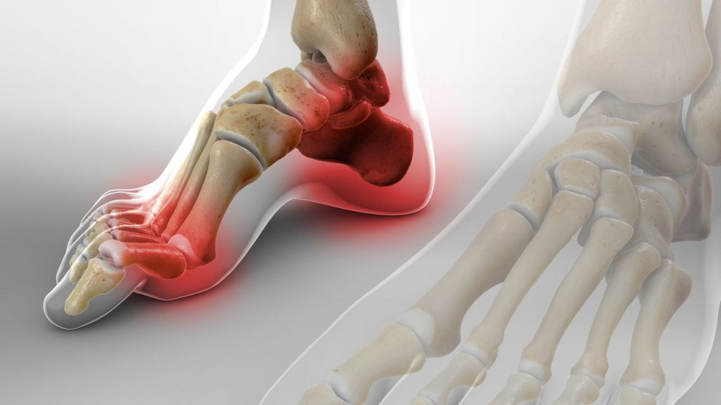 cavusfoot 1280