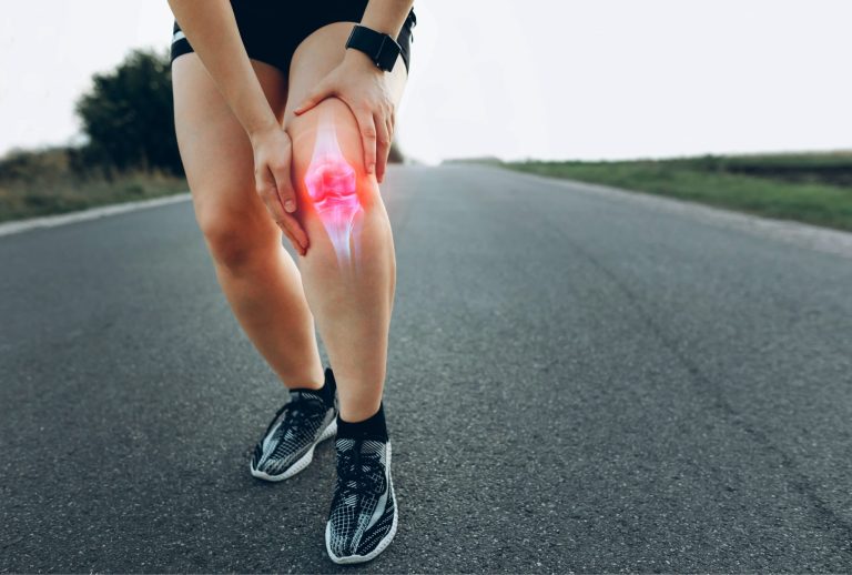 runners knee