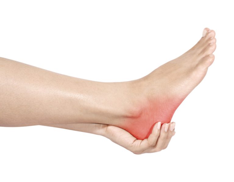 what is causing my heel pain neurospine surgical consultants 864x670